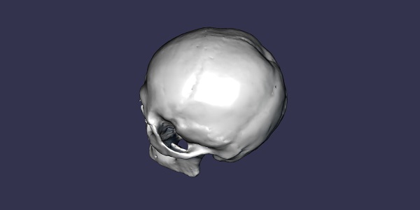 Skull