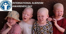 International Albinism Awareness Day